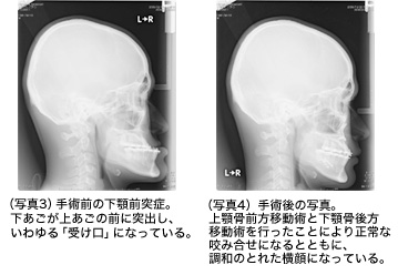写真3 写真4