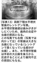写真13