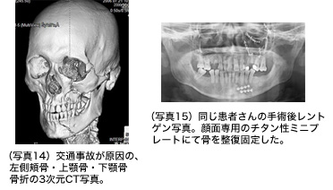 写真14 写真15